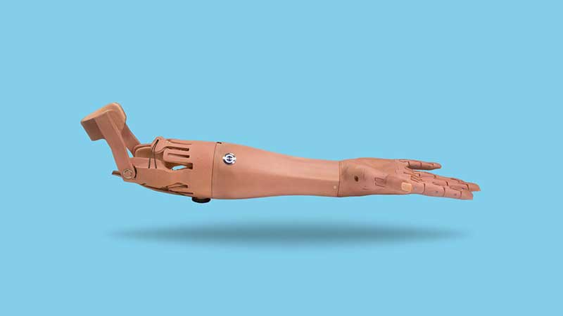 3d printed prosthetic limbs